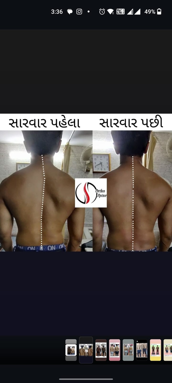 X-ray result 13