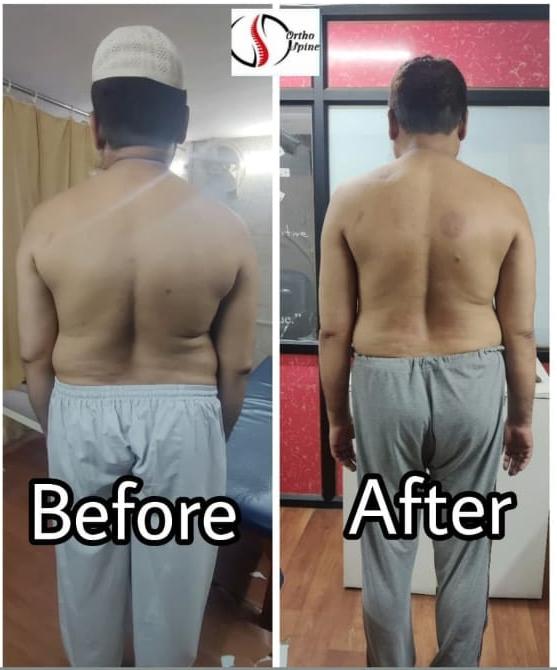 Patient result 4