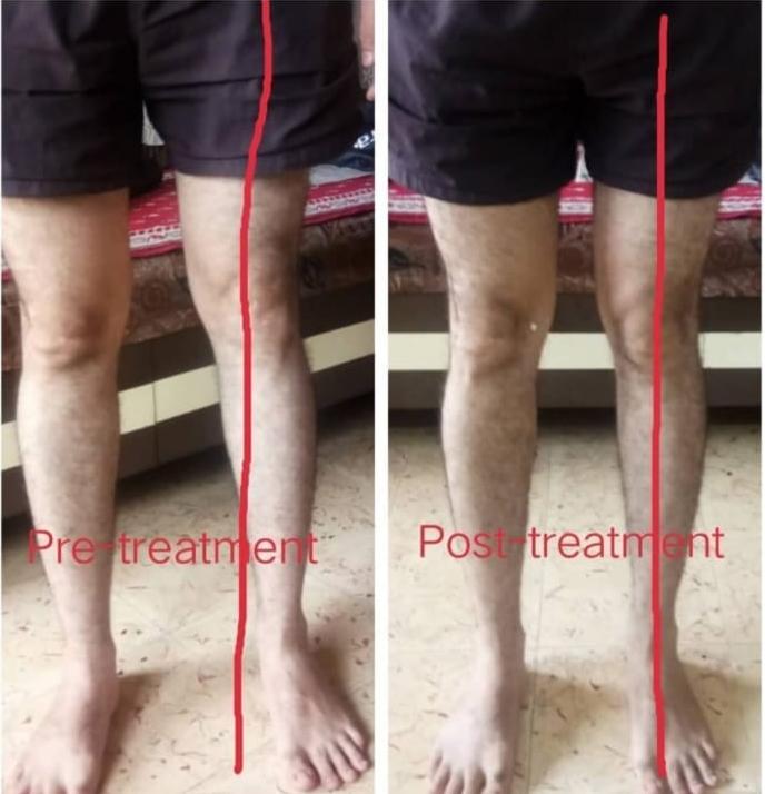 Patient result 11
